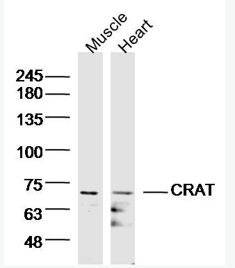 Anti-CRAT antibody-肉毒碱O-乙酰基转移酶