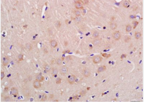 Anti-GLS2 antibody-谷氨酰胺酰胺水解酶抗体