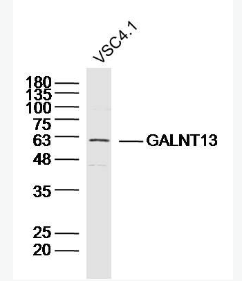 Anti-GALNT13 antibody-多肽N-乙酰氨基半乳糖转移酶13抗体