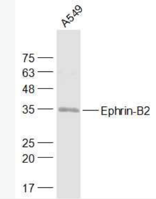 Anti-Ephrin-B2  antibody-Ephrin-B2抗体