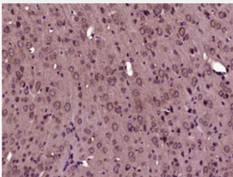 Anti-phospho-FLNC (Ser2233) antibody-磷酸化细丝蛋白2抗体