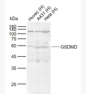 Anti-GSDMD antibody-Gasdermin D蛋白抗体