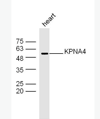 Anti-KPNA4 antibody-KPNA4蛋白抗体