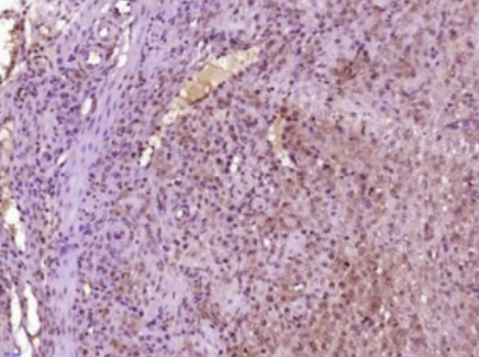 Anti-SHOX2 antibody-身材矮小同源盒基因SHOX2抗体