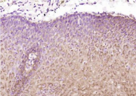 Anti-SPINK5/LEKTI antibody-丝氨酸蛋白酶抑制剂SPINK5抗体