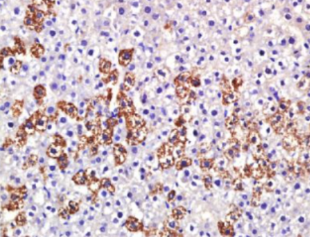 Anti-Granuphilin/SYTL4 antibody-突触结合蛋白样蛋白4抗体