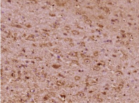 Anti-SPINK6 antibody-丝氨酸蛋白酶抑制剂SPINK6抗体