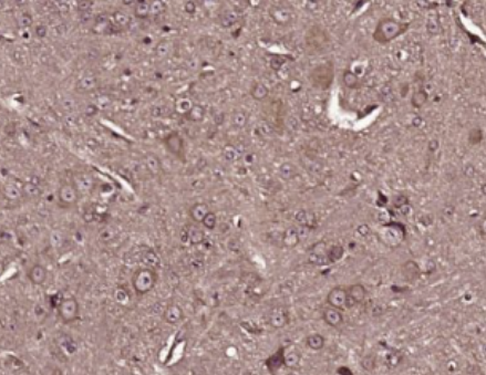 Anti-GLOD4 antibody-GLOD4蛋白抗体