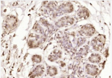 Anti-OGDH antibody-酮戊二酸脱氢酶OGDH抗体