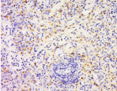 Anti-FAM3D antibody-FAM3D蛋白抗体