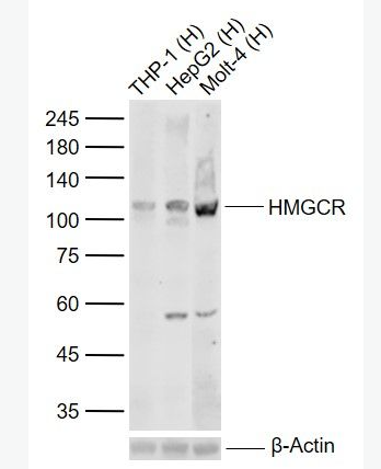 Anti-HMGCR antibody-HMGCR重组兔单抗