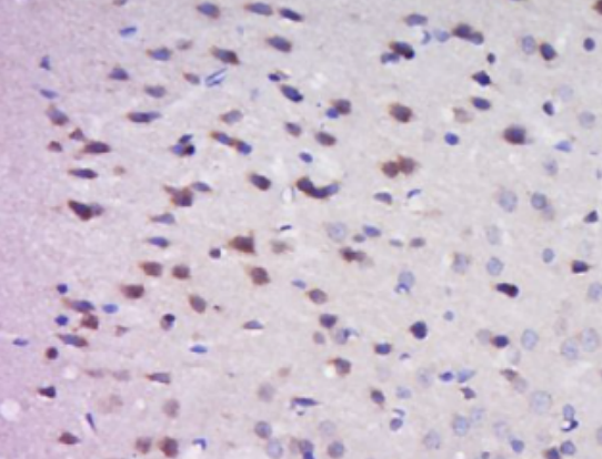 Anti-GRP antibody-促胃泌素释放肽抗体