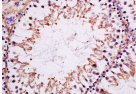 Anti-Serine/threonine protein kinase MAK antibody-丝氨酸/苏氨酸蛋白激酶MAK抗体