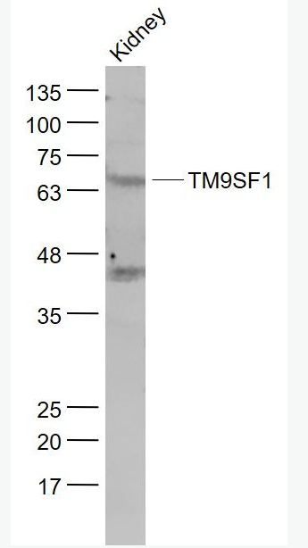 Anti-TM9SF1 antibody-跨膜蛋白超家族9-1抗体