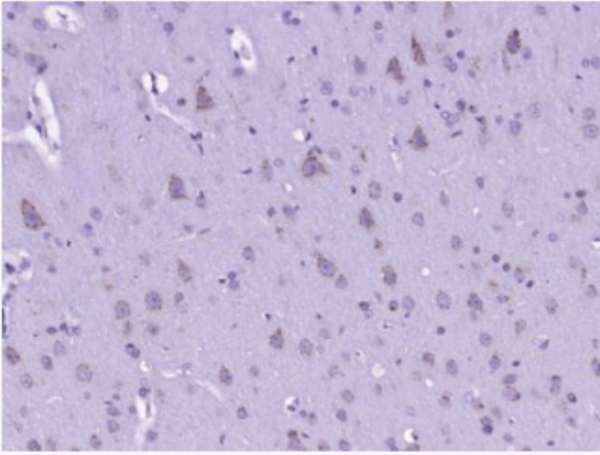 Anti-CARD12 antibody-凋亡加强结构域蛋白12抗体