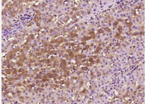 Anti-SAA1 antibody-血清淀粉样蛋白A抗体