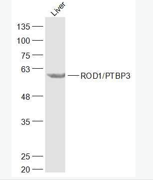 Anti-ROD1/PTBP3 antibody-调节分化蛋白ROD1抗体