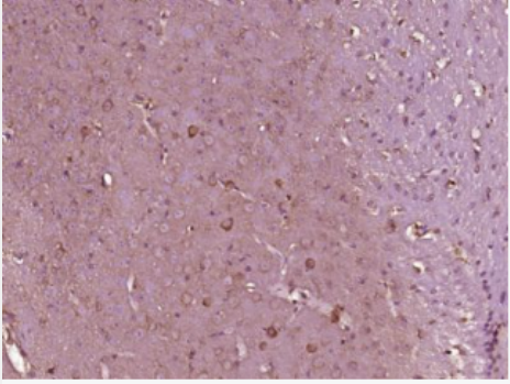 Anti-P5CS antibody-γ-5羧酸合成酶抗体