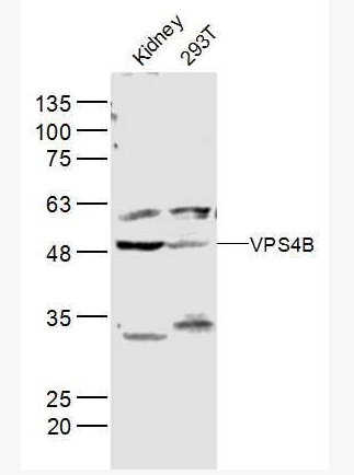 Anti-VPS4B antibody-液泡蛋白分选蛋白4B抗体