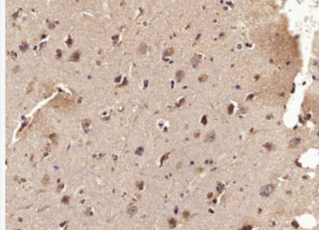 Anti-CCL2 antibody-淋巴细胞趋化因子CCL2抗体