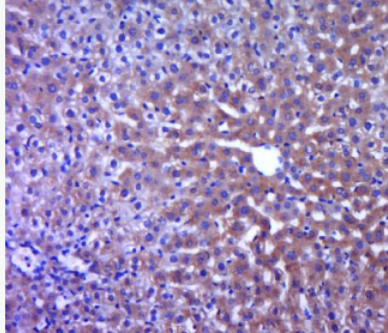 Anti-TNNC2 antibody-肌钙蛋白C2抗体