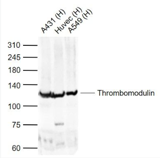 Anti-Thrombomodulin antibody-血栓调节蛋白抗体