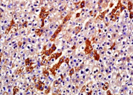 Anti-Collagen alpha-1(I) chain antibody-I型胶原蛋白