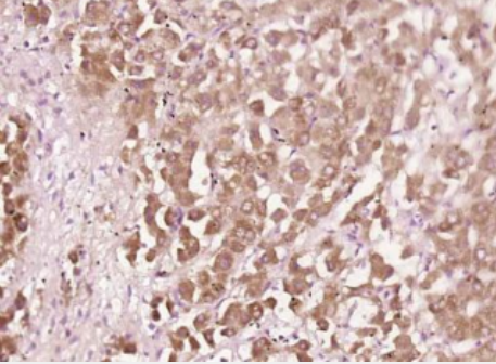 Anti-CXCL10/IP10 antibody-CXCL10趋化因子10/干扰素诱导蛋白10抗体