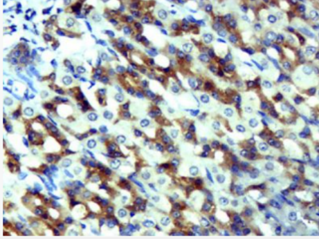 Anti-CCL5/RANTES antibody-T细胞特异性趋化因子抗体