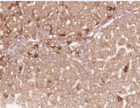 Anti-HBEGF antibody-肝素结合性表皮生长因子抗体