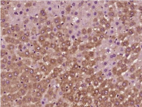 Anti-GCLM antibody-γ 谷氨酰半胱氨酸连接酶调节亚基