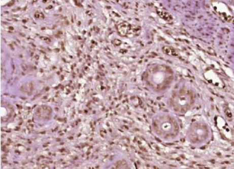 Anti-SMAD6 antibody-细胞信号转导分子SMAD6抗体