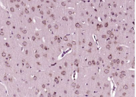 Anti-Heme Oxygenase 1antibody-血红素氧合酶 1/热休克蛋白32抗体