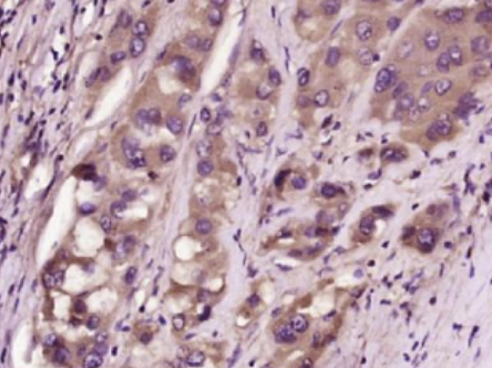 Anti-FGF21 antibody-成纤维细胞生长因子21抗体