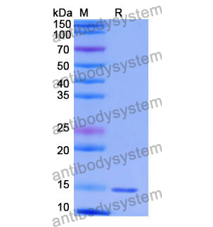 Anti-Human TRIM28 Nanobody (SAA1235)