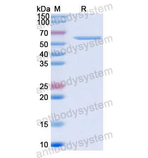 抗体：HSV-2/HHV-2 gD/Envelope glycoprotein D Antibody (SAA0365) RVV04901
