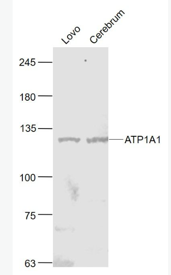 Anti-ATP1A1(Loading Control) antibody-钠钾ATP酶蛋白a1（内参）抗体