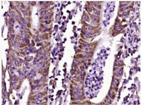 Anti-CEA  antibody-癌胚抗原单克隆抗体