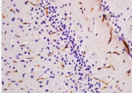 Anti-NGFB antibody-神经生长因子β单克隆抗体