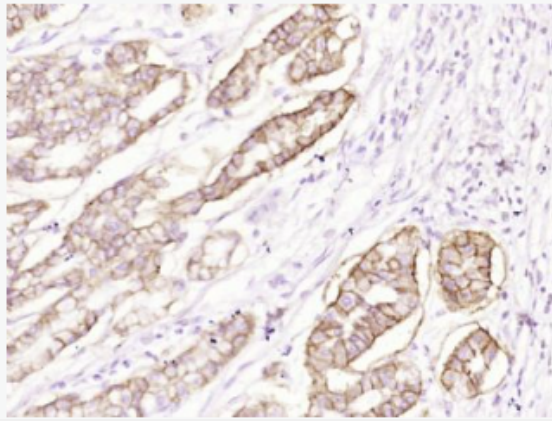 Anti-CA9 antibody-碳酸酐酶9单克隆抗体