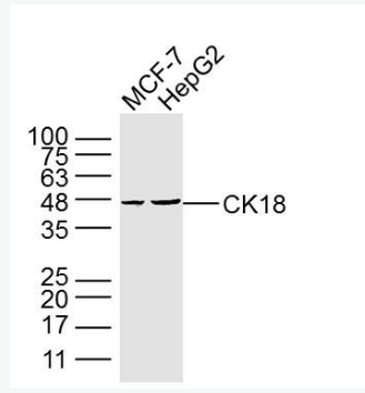 Anti-CK18  antibody-细胞角蛋白18单克隆抗体