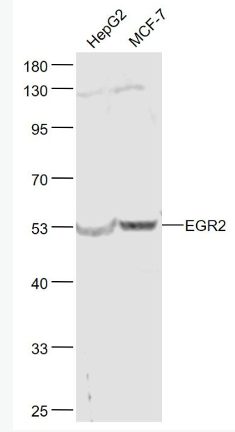Anti-EGR2  antibody-早期生长反应蛋白2抗体