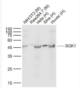 Anti-SGK1 antibody-糖皮质激素调节激酶1单克隆抗体
