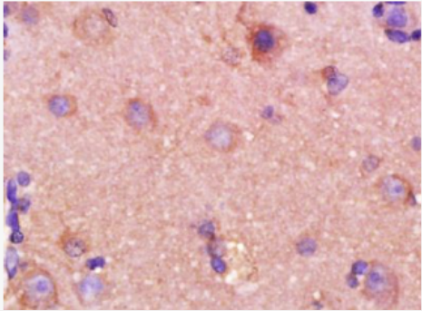 Anti-AMMP2 antibody-基质金属蛋白酶2单克隆抗体