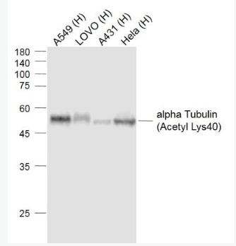 Anti-alpha Tubulin (Acetyl Lys40) antibody-乙酰化微管蛋白α/Tubulin α/α-tubulin单克隆抗体