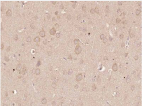 Anti-ERK1 antibody-丝裂原活化蛋白激酶1单克隆抗体