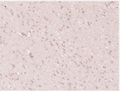 Anti-Cleaved PARP1 antibody-多腺苷二磷酸多聚酶/多聚ADP-核糖聚合酶1单克隆抗体