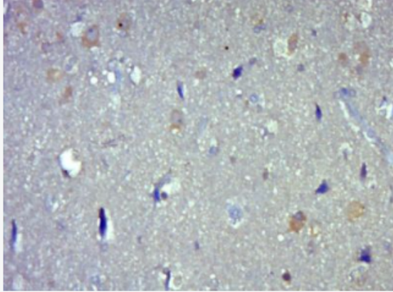 Anti-Smad3 antibody-细胞信号转导分子SMAD3单克隆抗体