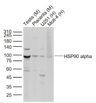 Anti-HSP90 alpha antibody-热休克蛋白90α抗体