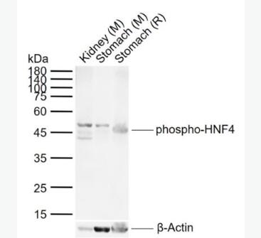 Anti-phospho-HNF4 (Ser313) antibody-磷酸化肝细胞核因子4α抗体